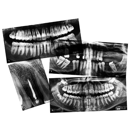 [6705] RADIO DES DENTS